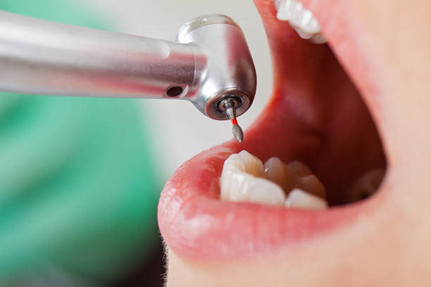 Best Emergency Broken Tooth Repair in Henryville, IN